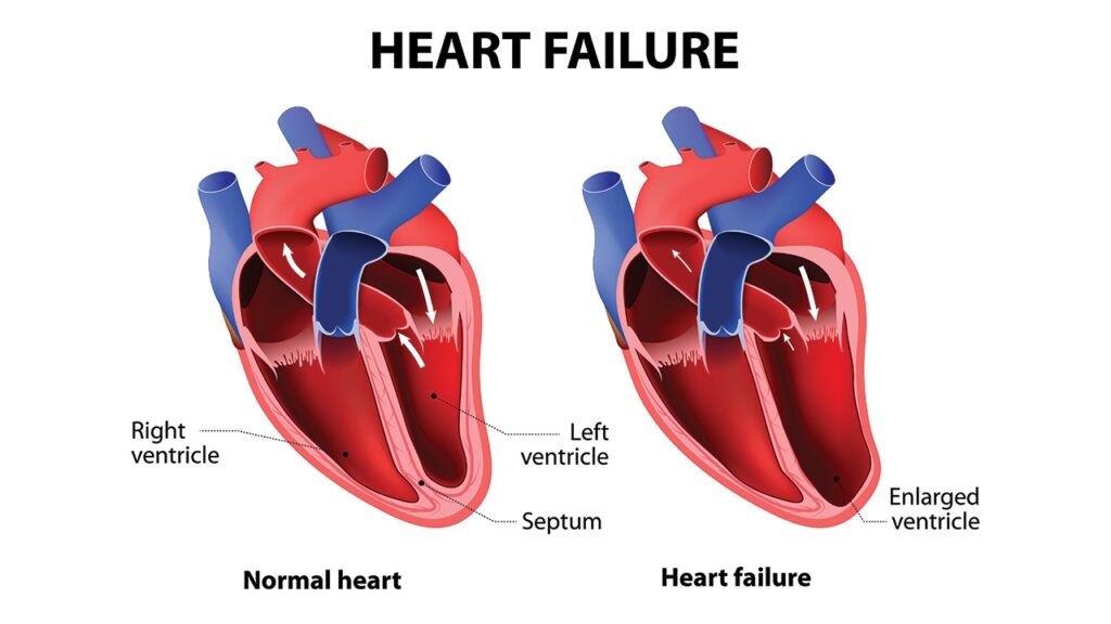 Best Heart Failure Doctor in Mulund, Airoli